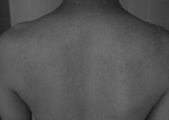 Dureri De Spate Lombare – Cauze Frecvente