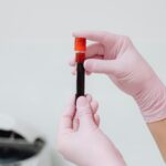 Cum te ajută testele de laborator să îți înțelegi mai bine organismul – Synevo