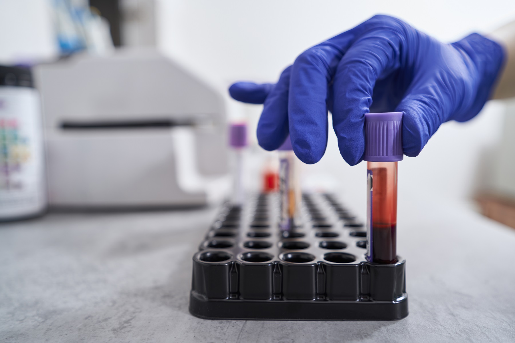 Ce este sindromul metabolic?