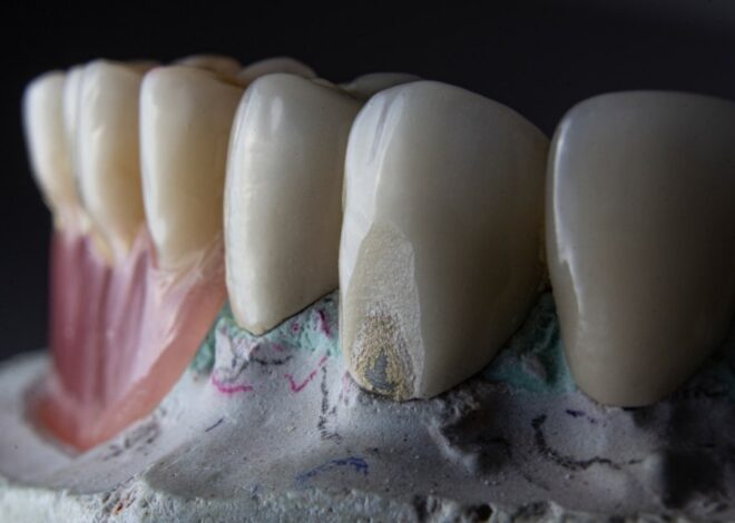 Cum să previi sensibilitatea dentară