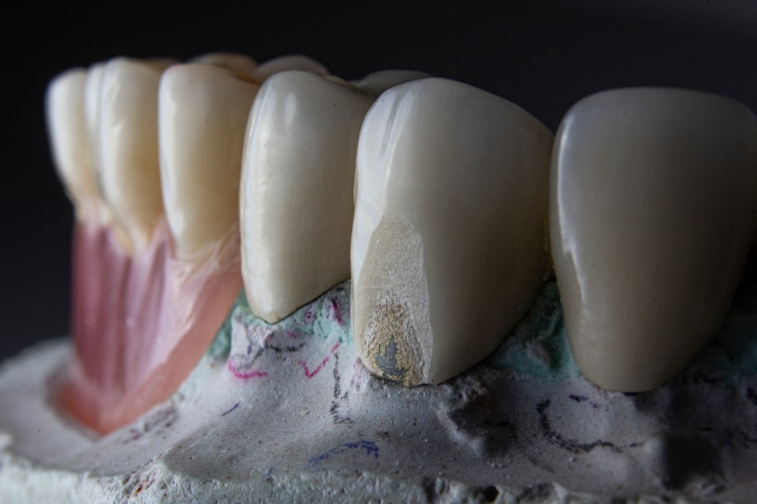 Cum să previi sensibilitatea dentară