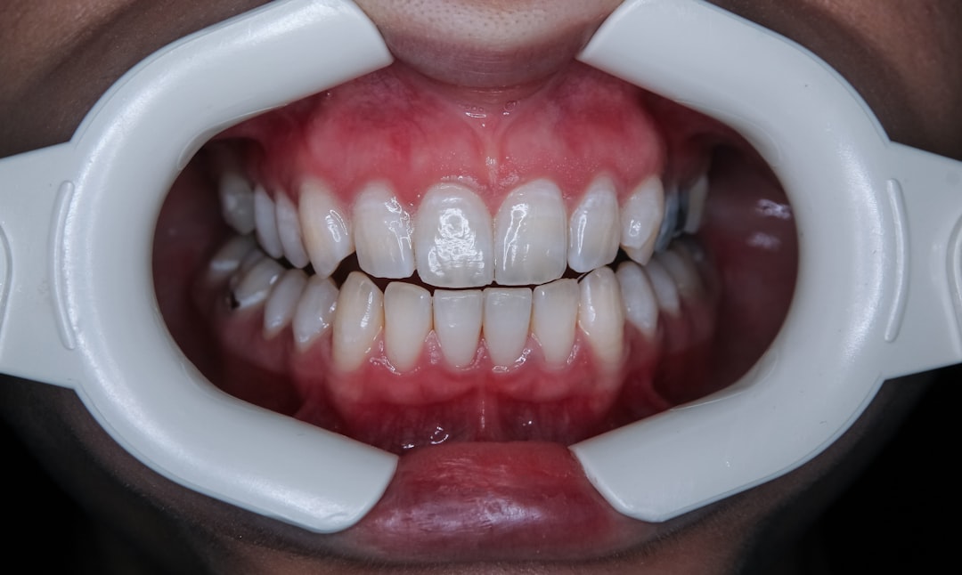Durere dupa cimentarea puntii dentare – cauze, simptome si solutii eficiente