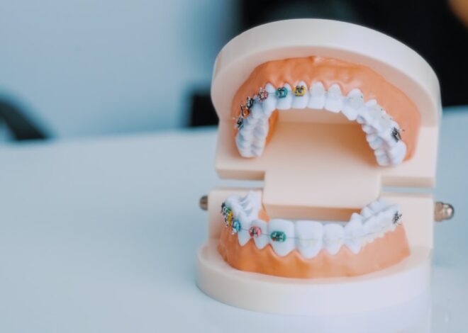 Cum să-ți îngrijești dinții după tratamente stomatologice