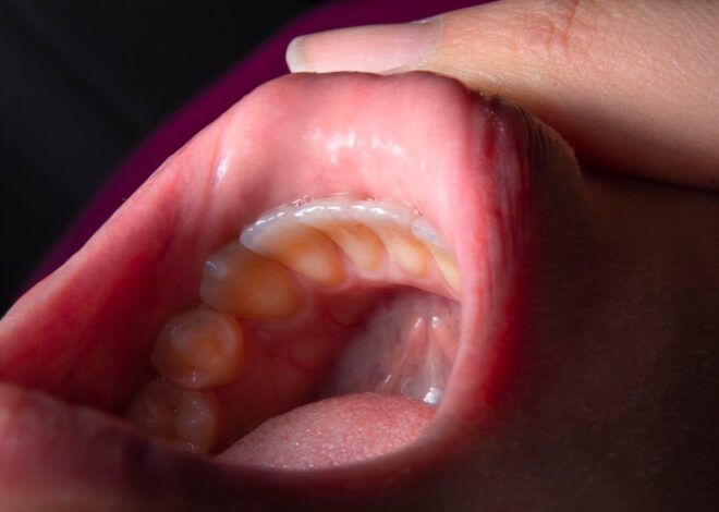 Cum să cureți eficient limba și gingiile: ghid complet