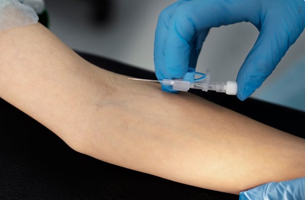 Ce este și cum funcționează un detector de vene?