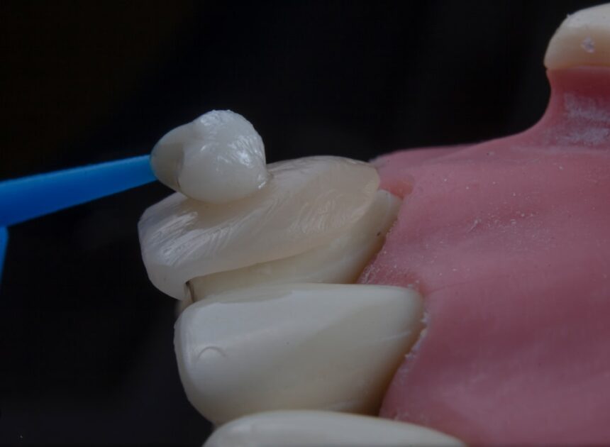 Cum să cureți protezele dentare eficient