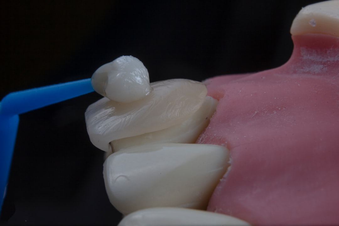 Cum să cureți protezele dentare eficient