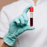 Când este necesar un panel autoimun extins? 5 situații în care îl recomandă medicii