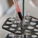 Ce analize de sânge ar trebui să faci după 40 de ani, chiar dacă te simți bine — MEDANET