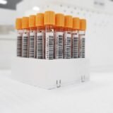 Eprubete cu probe de sânge așezate într-un suport, într-un laborator de analize medicale